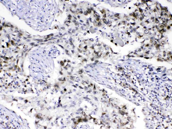 MED18 Antibody