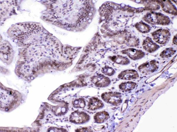 MED18 Antibody