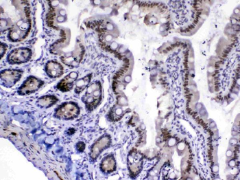 MED18 Antibody