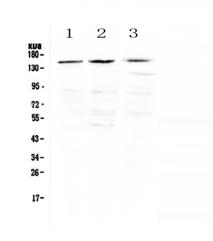 TrkA/NTRK1 Rabbit Polyclonal Antibody
