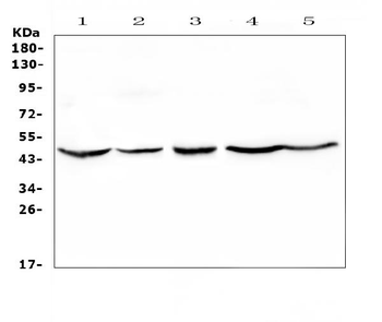HMBS Rabbit Polyclonal Antibody
