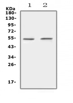 Protein C/PROC Rabbit Polyclonal Antibody