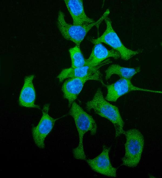 HGD Rabbit Polyclonal Antibody
