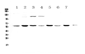 Nicotinic Acetylcholine Receptor alpha 3/CHRNA3 Rabbit Polyclonal Antibody