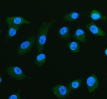Fatty Acid Binding Protein 5/FABP5 Rabbit Polyclonal Antibody
