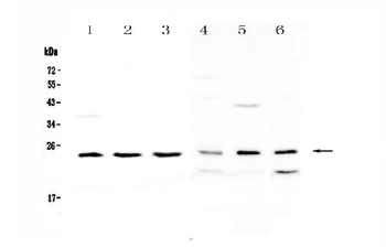 RAB6A Rabbit Polyclonal Antibody