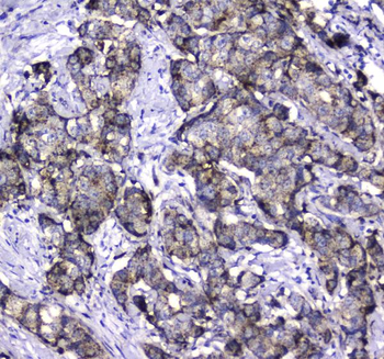 LGALS3BP Rabbit Polyclonal Antibody