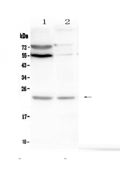 LMO2 Rabbit Polyclonal Antibody