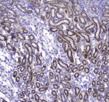 COX IV/COX4I1 Antibody
