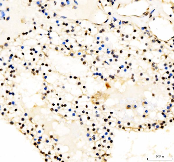 JunD Rabbit Polyclonal Antibody