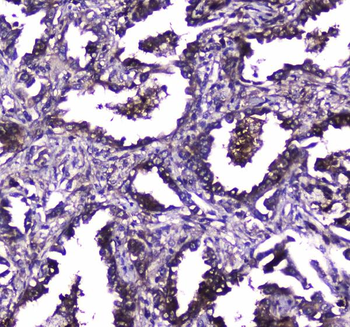 TLR1 Rabbit Polyclonal Antibody