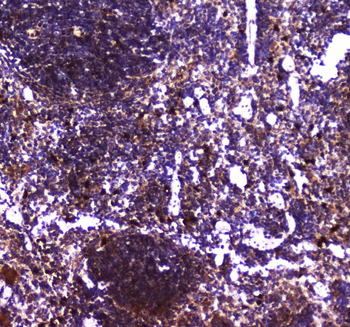 TLR1 Rabbit Polyclonal Antibody