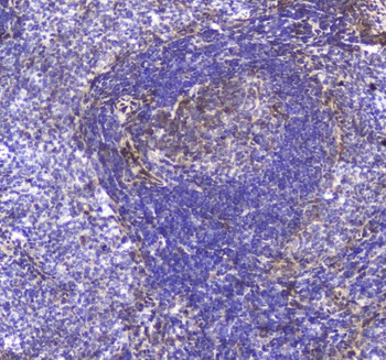 TLR1 Rabbit Polyclonal Antibody