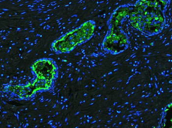 Lactoferrin/LTF Rabbit Polyclonal Antibody