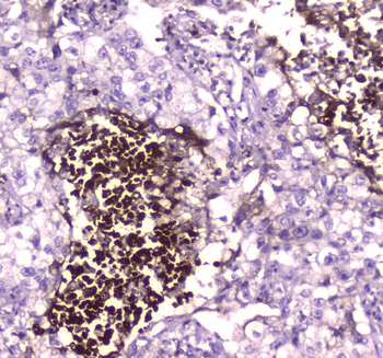 Lactoferrin/LTF Rabbit Polyclonal Antibody