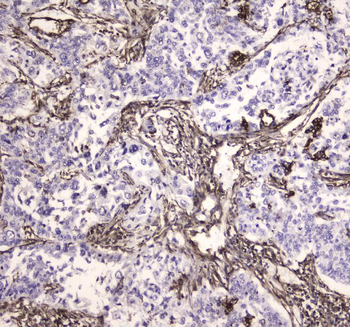 MVP Antibody