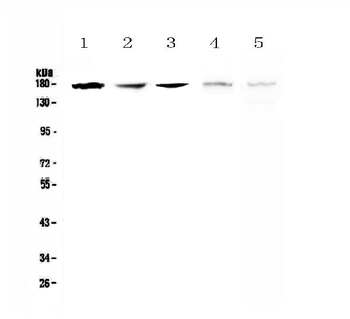 IRE1/ERN1 Rabbit Polyclonal Antibody