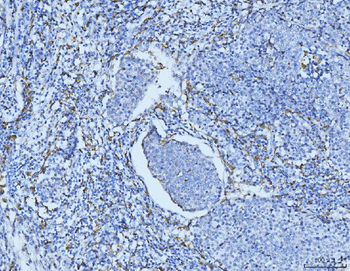 CD163 Antibody
