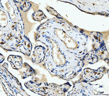 CD163 Antibody