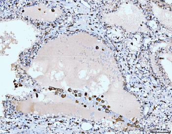 CD163 Antibody