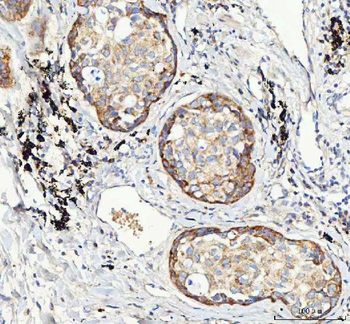 Mannose 6 Phosphate Receptor (Cation independent)/IGF2R Antibody