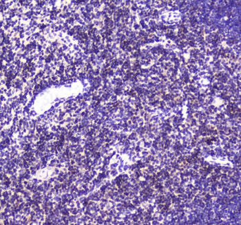 CBFb Antibody