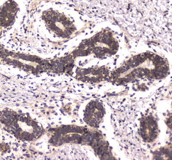RNA polymerase II RPB1/POLR2A Rabbit Polyclonal Antibody