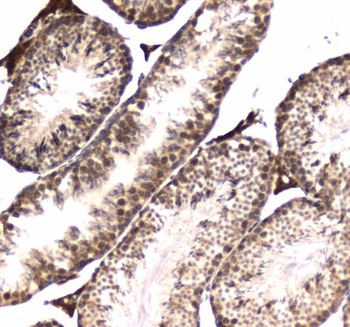 RNA polymerase II RPB1/POLR2A Rabbit Polyclonal Antibody