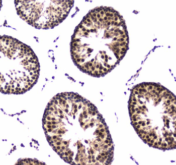 RNA polymerase II RPB1/POLR2A Rabbit Polyclonal Antibody