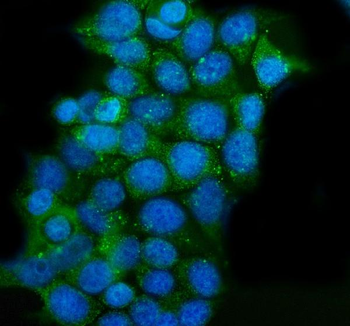CLPP Antibody