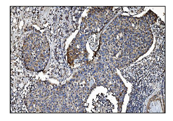 CLPP Antibody