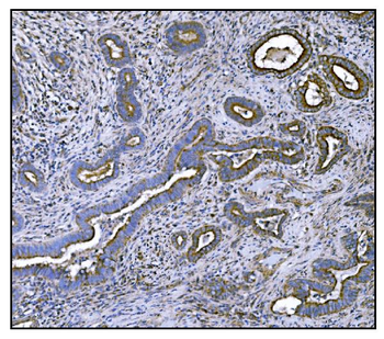 CLPP Antibody