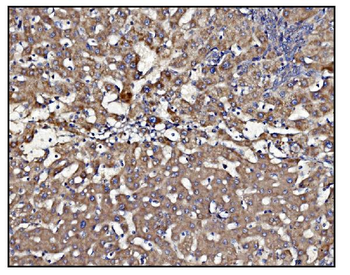 CLPP Antibody