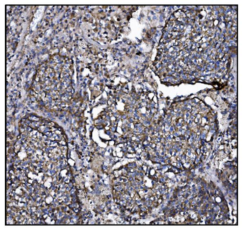 CLPP Antibody