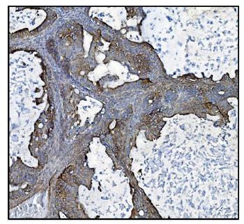 CLPP Antibody