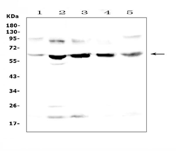 Steroid sulfatase/STS Rabbit Polyclonal Antibody