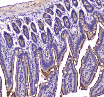 Cannabinoid Receptor I/CNR1 Rabbit Polyclonal Antibody