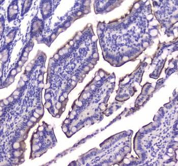 Cannabinoid Receptor I/CNR1 Rabbit Polyclonal Antibody