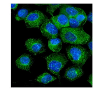 VAPB Antibody