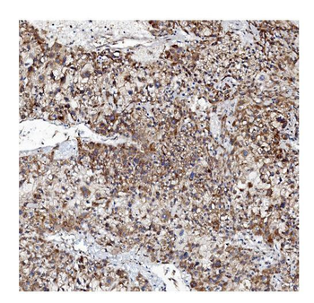 VAPB Antibody