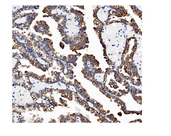 VAPB Antibody