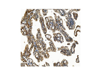 VAPB Antibody
