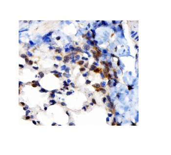 VAPB Antibody