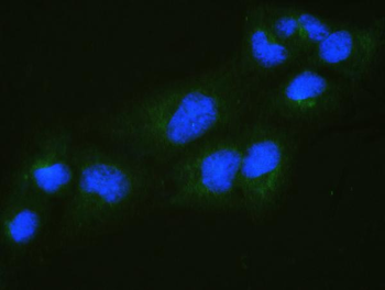 RALBP1 Rabbit Polyclonal Antibody