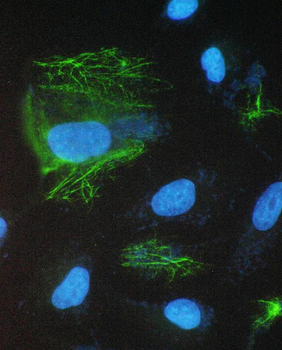 epithelial Sodium Channel alpha/SCNN1A Antibody