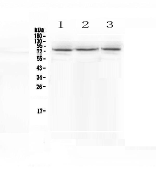 epithelial Sodium Channel alpha/SCNN1A Antibody