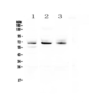 Bestrophin/BEST1 Rabbit Polyclonal Antibody
