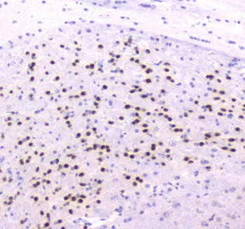 strogen Related Receptor gamma/ESRRG Rabbit Polyclonal Antibody