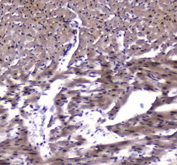 strogen Related Receptor gamma/ESRRG Rabbit Polyclonal Antibody