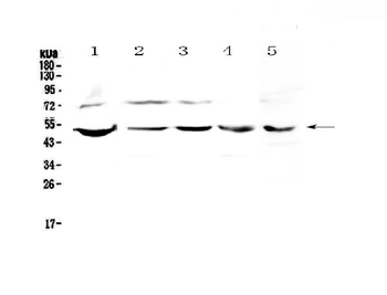 strogen Related Receptor gamma/ESRRG Rabbit Polyclonal Antibody